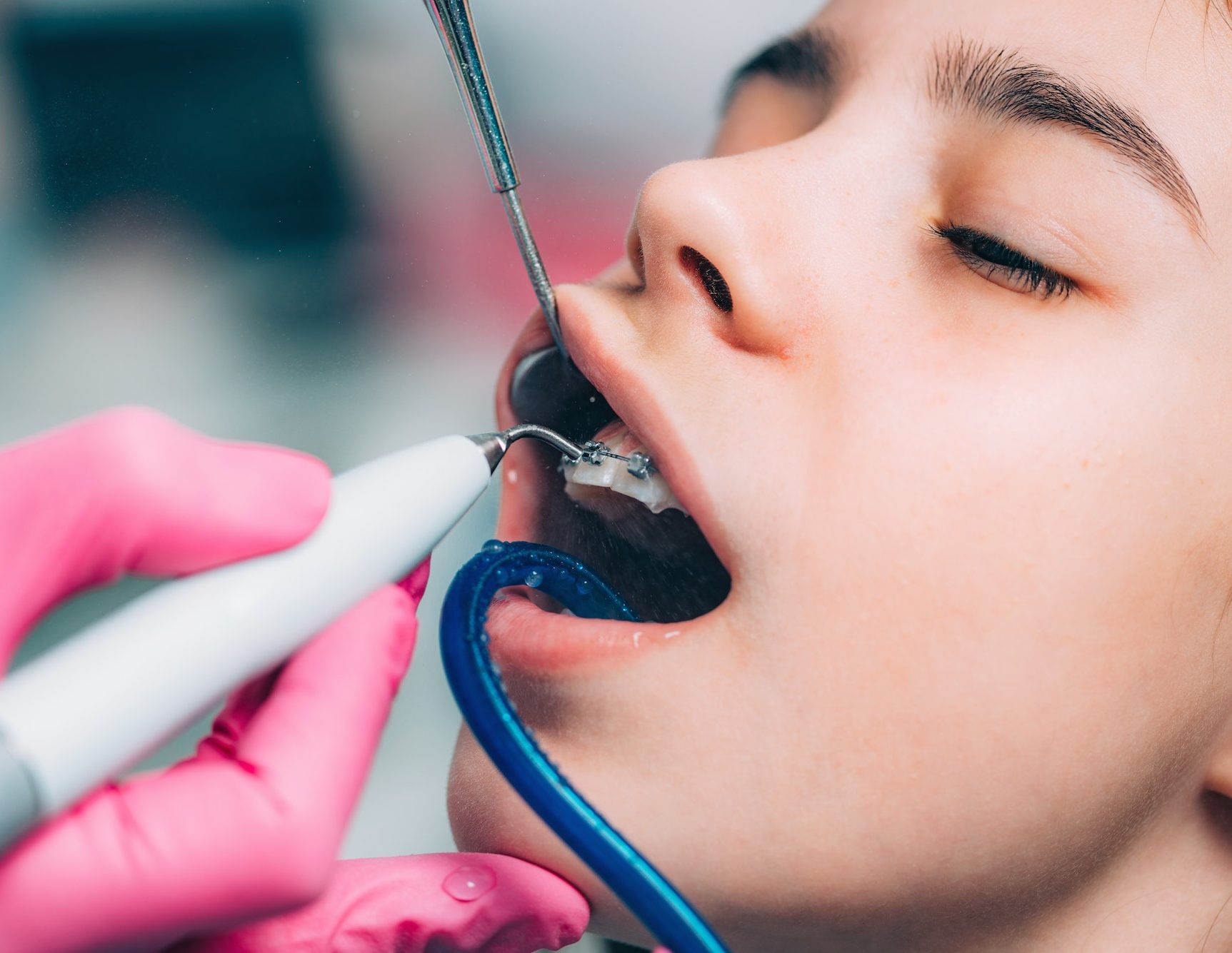 Orthodontist cleaning girl’s teeth with dental braces