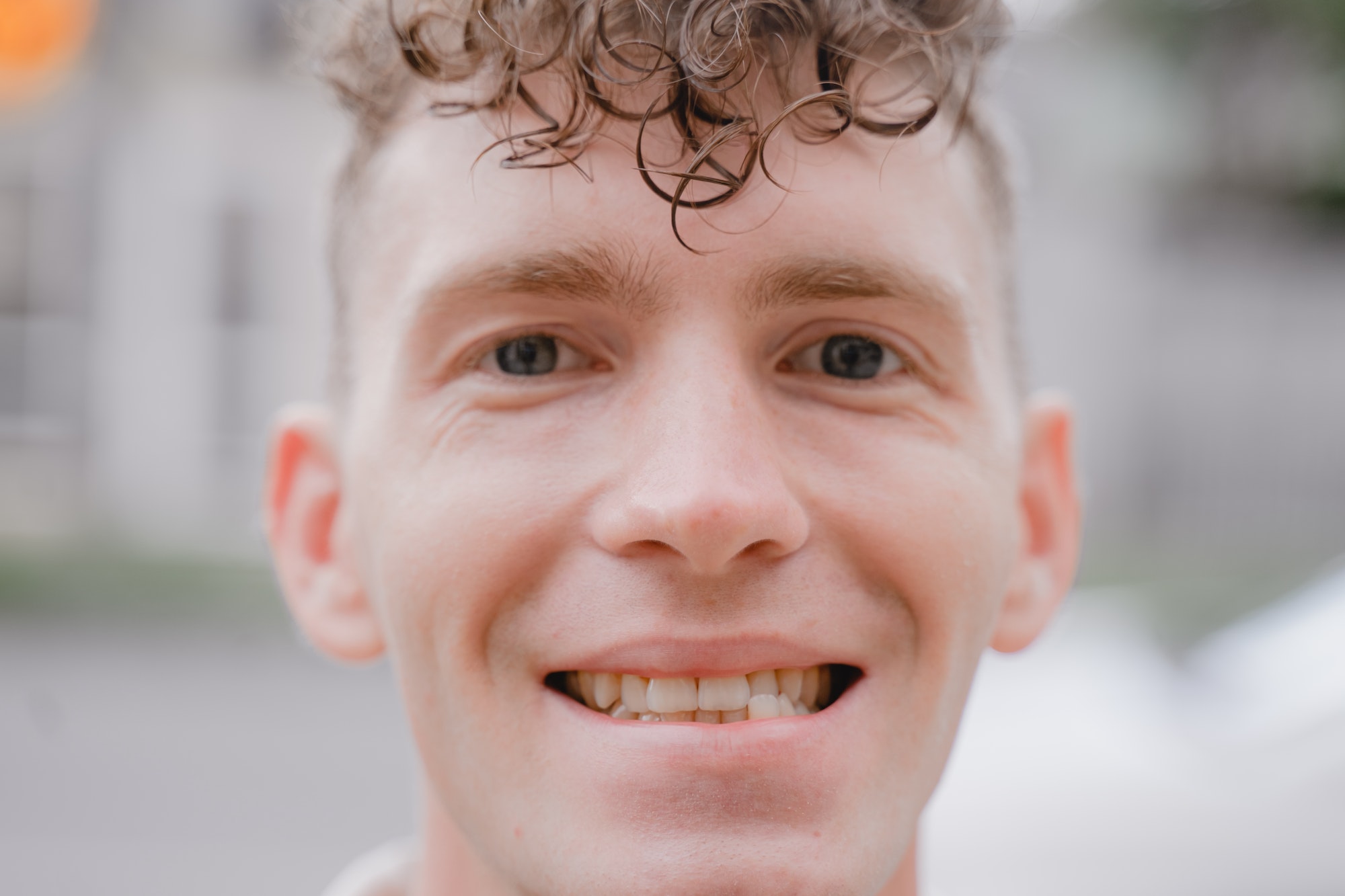 portrait of a smiling guy with misaligned bite