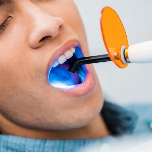 close up of african american man during whitening procedure